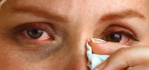 Слезотечение глаз: лечение, причины, симптомы, признаки