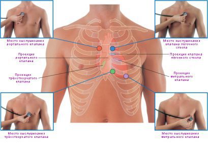 Аускультация сердца