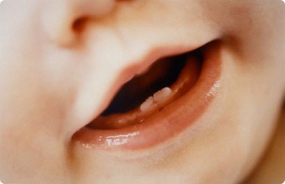 Ортодонтические аномалии детских зубов