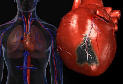 Травматические поражения сердца и сосудов