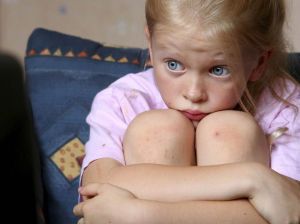 Тревожные расстройства у детей: лечение, симптомы, причины