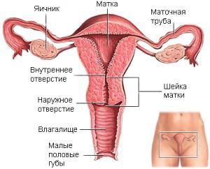 Рак яичников: симптомы, лечение, признаки, причины