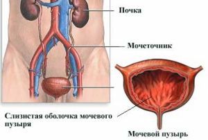 Мочевой синдром: симптомы, диагностика, лечение, причины