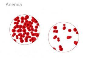 Анемия и скрытая кровопотеря через желудочно-кишечный тракт