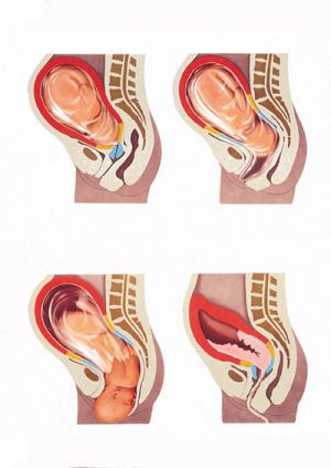 Периоды родов: первый, второй, третий периоды