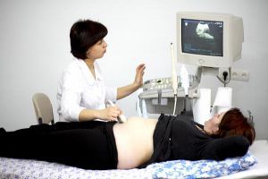 Индукция беременности