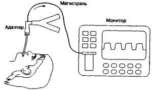 Парциальное давление углекислого газа. Капнография