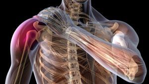 Повреждения плечевого сплетения: лечение, причины