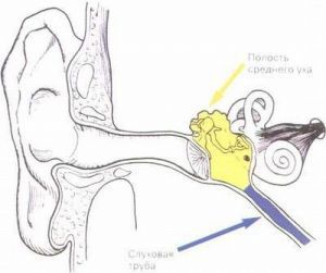 Острый средний отит: что это такое, лечение, симптомы, признаки, причины