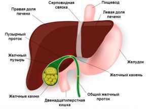 Камни в желчном пузыре, симптомы, лечение, операция, причины, признаки, удаление