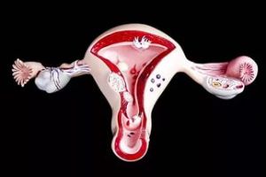 Нерегулярные вагинальные кровотечения: причины, лечение