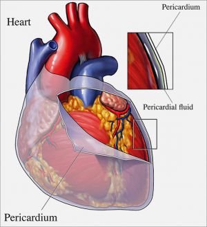 Перикард сердца: что это такое, лечение, причины, симптомы, признаки