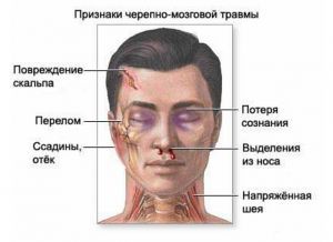 Черепно-мозговая травма: первая помощь, лечение, последствие, симптомы, признаки, причины