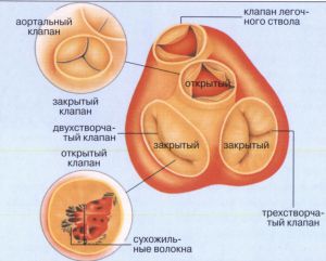 Пороки клапана легочной артерии (стеноз, недостаточность), лечение, причины, симптомы, признаки