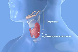 Заболевания щитовидной железы, симптомы, признаки, лечение