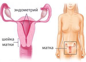 Гиперплазия эндометрия матки: лечение, признаки, причины, симптомы
