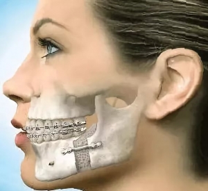 Сочетанные травмы челюстно-лицевой области: что это такое, лечение, причины, симптомы, признаки