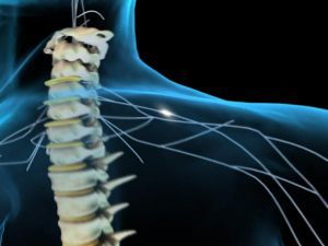 Компрессия спинного мозга и миелосупрессия: симптомы