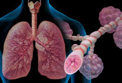 Бронхиальная астма: лечение, симптомы, причины, признаки, диагностика