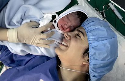 Кесарево сечение, операция, последствия, показания, восстановление Кесарево сечение, операция, последствия, показания, восстановление
