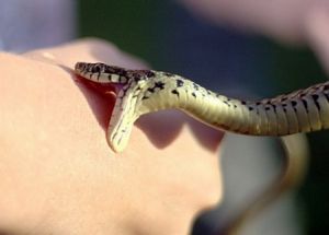 Укус змеи: симптомы, первая помощь, лечение, последствия