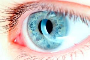 Макулодистрофия сетчатки глаза: лечение, симптомы, причины, профилактика