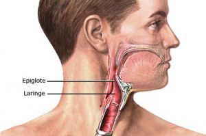 Эпиглоттит: лечение, симптомы, диагностика, причины