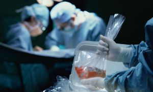 Трансплантация и донорство органов