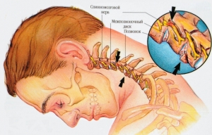 Проблемы с шеей