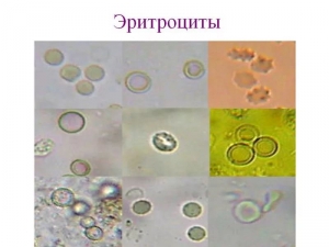 Микроскопическое исследование (анализ) осадка мочи