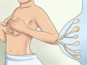 Лимфангиомы грудного протока: лечение, причины, симптомы, признаки
