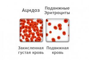 Нарушение кислотно-щелочного баланса в организме: симптомы, лечение, причины, признаки