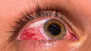 Болезни глаз у человека: симптомы, причины, признаки, лечение