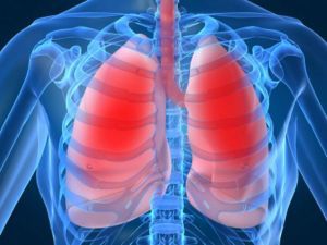 Опухоли дыхательных путей: лечение, симптомы, диагностика