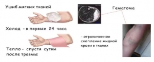 Повреждения мягких тканей: первая помощь, симптомы, признаки, лечение