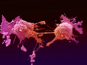 Цитоморфология рака легкого