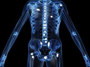 Метастазы в костях: лечение, прогноз, симптомы, признаки, диагностика