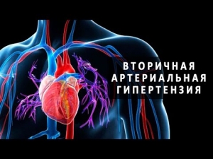 Вторичные артериальные гипертонии