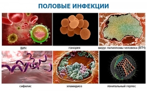 Половые болезни: что это такое, какие виды, симптомы, профилактика, признаки, лечение