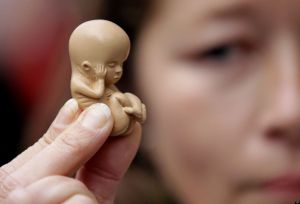 Разоблачение мифов относительно аборта