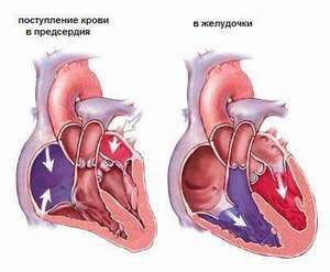 Оценка функции желудочков сердца