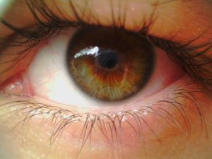 Пигментная дистрофия сетчатки глаза: лечение