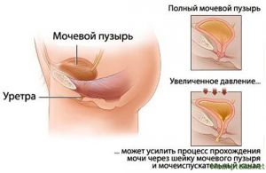 Травмы передней уретры: лечение, причины, симптомы, признаки