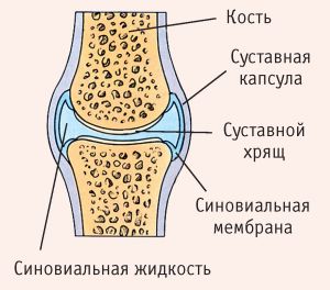 Костные компоненты сустава Костные компоненты сустава
