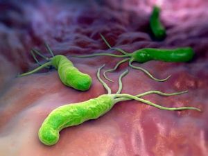 Инфекция helicobacter pylori: лечение, симптомы, причины, диагностика, признаки
