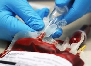 Трансфузия крови: проведение, показания, осложнения