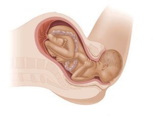 Второй период родов: начало, течение, введение
