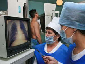 Туберкулез легких: что это такое, симптомы, лечение, признаки, причины Туберкулез легких: что это такое, симптомы, лечение, признаки, причины