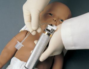 Интубация новорожденных: трубная техника интубации трахеи