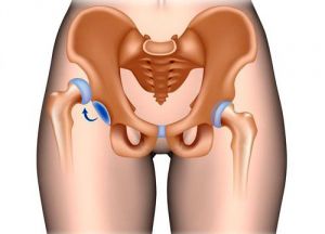 Переломы костей таза и повреждения органов мочевыделительной системы: причины, симптомы, лечение, признаки